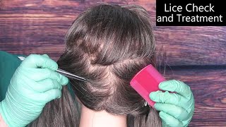 ASMR Lice Check and Treatment Tweezers Scalp Treatment Lice Comb Whispering Medical Roleplay [upl. by Asselam]