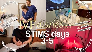 IVF diaries pt 5  STIMS days 35 adding Cetrotide injection symptoms amp how Im doing so far [upl. by Kono]