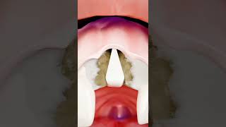 Unknown Facts About Tooth Implant shorts facts teeth [upl. by Eirrehs]