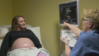 Ultrasounds during pregnancy [upl. by Ahsuatal]