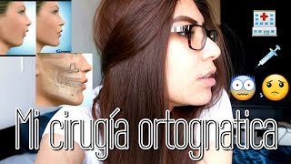 Mi Futura Cirugia OrtognaticaMaxilofacial Clase 2 [upl. by Aciretahs36]