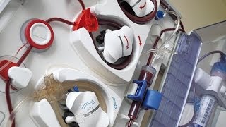 Hypertension in Dialysis Patients [upl. by Ahoufe716]