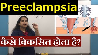 Pathogenesis of Preeclampsia in Hindi हिंदी  Pregnancy induced Hypertension  Nursing Lecture [upl. by Clough]