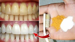 Magical Teeth Whitening home Remedy Get whiten Teeth at home in 3 minutes [upl. by Egiedan]