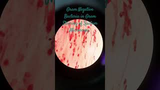 Gram Negative Bacteria in Gram Staining of Sputum Microscopy at various magnifications [upl. by Matthei179]