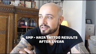 Scalp Micro Pigmentation SMP after 1 year [upl. by Merc434]