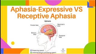 AphasiaExpressive VS Receptive Aphasia  Fluent amp NonFluent Aphasia  PhysiotherapyKnowledge [upl. by Jamila790]