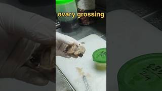 Ovary grossing video  histopathology ovariancyst cyst ovaryhistology [upl. by Eikram253]