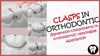 CLASPS IN ORTHODONTICS Part1  RETENTIVE COMPONENT IN REMOVABLE APPLIANCES  BY DENTAL CAFE [upl. by Ayoras718]