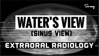 WATERS VIEW II REFERRED AS quotSINUS VIEWquot II EXTRAORAL RADIOGRAPHY [upl. by Niret]