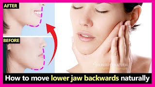 How to fix underbite protruding jaw move lower jaw backwards naturally  Prognathism jaw exercises [upl. by Anoif]