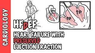 HFpEF  Heart Failure with Preserved Ejection Fraction [upl. by Kela]