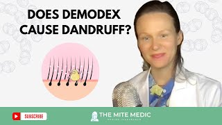 THE HIDDEN CAUSE OF DANDRUFF Demodex Mites and itchy scalp [upl. by Attenoj427]