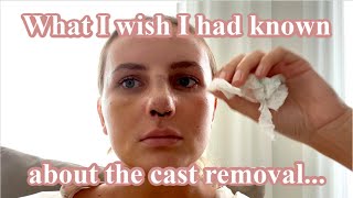 WHY DID NOBODY WARN ME Emotional nose job reveal  My Septoplasty amp Rhinoplasty Journey  Pt 2 [upl. by Wendalyn]