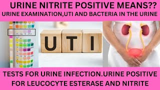 URINARY NITRITE TESTPOSITIVE URINARY NITRITEBACTERIA IN THE URINEURINARY TRACT INFECTION UTI [upl. by Osicnarf]