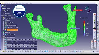 CATIA v5 How to import refine repair and transform to solid a mandible scanned surface [upl. by Kir269]