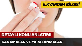 İlkyardım Bilgisi  Kanamalar ve Yaralanmalar [upl. by Erminie]