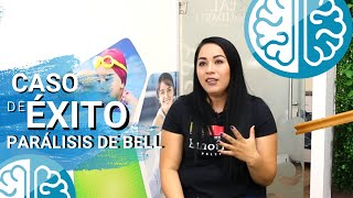 TRATAMIENTO de PARALISIS de BELL ► ¿Qué ejercicios hacer 😚¡CASO DE ÉXITO Fisioterapia Guadalajara [upl. by Enorel508]