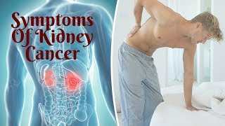 SYMPTOMS OF KIDNEY CANCER [upl. by Kyte]