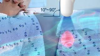 Theory of Badder Scanning  How to perform a bladder scan [upl. by Deeas]