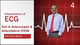 ECG Part 4 Anteroseptal amp Anterolateral STEMI final [upl. by Nottirb]