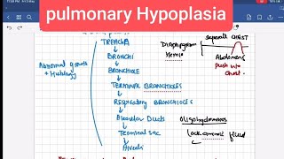 pulmonary Hypoplasia Pathology 3  First Aid USMLE Step 1 in UrduHindi [upl. by Grinnell]