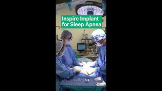 Inspire Implant for Sleep Apnea [upl. by Krutz]