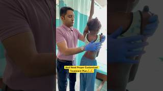 Most severe case of scoliosis chiropractic treatment by DrRavi scoliosis chiropractor trending [upl. by Zela809]