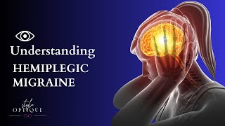 Stroke vs Hemiplegic Migraine  How To Tell The Difference hemiplegic migraine stroke [upl. by Slosberg879]