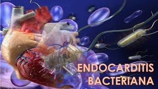 ENDOCARDITIS BACTERIANA  MEDICINA HUMANA [upl. by Yenreit]