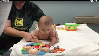 BABY GETS PHYSICAL THERAPY FOR TORTICOLLIS [upl. by Tanaka]