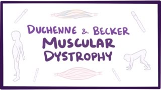 Duchenne amp Becker muscular dystrophy  causes symptoms treatment amp pathology [upl. by Ahcas]