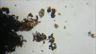 pond water sample under microscope [upl. by Lay]