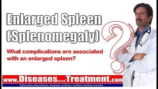 Enlarged Spleen Splenomegaly What complications are associated with an enlarged spleen [upl. by Noed]