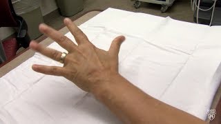 Mayo Clinic Minute What may be causing your hands and feet to tingle [upl. by Amrak]