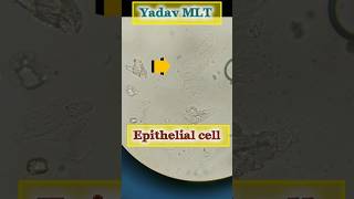 epithelial cell urine microscopy labtechnician shortyadavmlt4652 [upl. by Aitselec345]