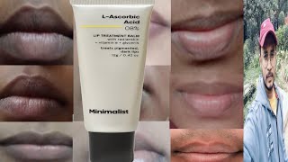 Minimalist L Ascorbic Acid 8 Lip Treatment Balm  Honest Review [upl. by Nevuer]