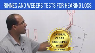 Rinnes and Webers Tests for Hearing Loss  ENT [upl. by Orbadiah]