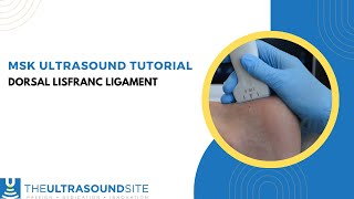 How to evaluate the dorsal fibres of the Lisfranc ligament on ultrasound in the foot [upl. by Hnilym]