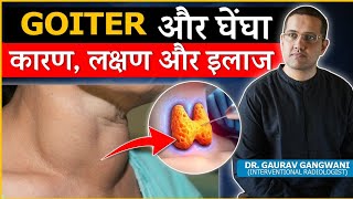 Important Things To Know About Thyroid Goiter  Dr Gaurav Gangwani Interventional Radiologist [upl. by Raffaello499]