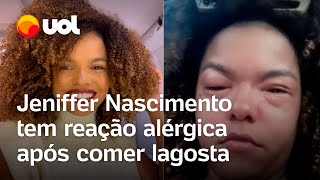 Jeniffer Nascimento tem reação alérgica após comer lagosta Muito severa [upl. by Sibie]