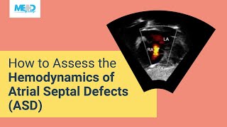 How to Assess the Hemodynamics of Atrial Septal Defects ASD [upl. by Rotman]