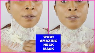 HOW I TIGHTEN AND FIRM MY NECK GET RID OF WRINKLES AND LOOSE SKIN USING A NATURAL REMEDY AT HOME [upl. by Demaggio213]