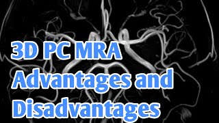 3D PC MRA Advantages and Disadvantages sk rad tech [upl. by Iruy502]