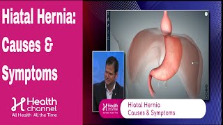 Hiatal Hernia Causes amp Symptoms [upl. by Alded]