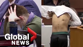 Nikolas Cruz trial Parkland school shooting survivor shows scars from bullet wounds [upl. by Haggi]