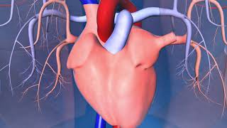 Catheter Ablation What is it and how does it help an irregular heart beat [upl. by Oap687]