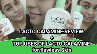 LACTO CALAMINE LOTION REVIEW AND USES [upl. by Ylellan233]