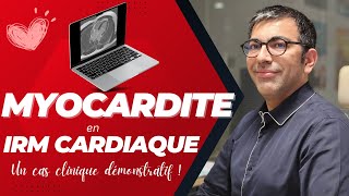 Myocardite en IRM cardiaque  tout comprendre en 15 minutes [upl. by Home]