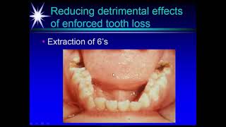 INTRAORAL EXAMINATION 2021 02 20 [upl. by Redyr334]